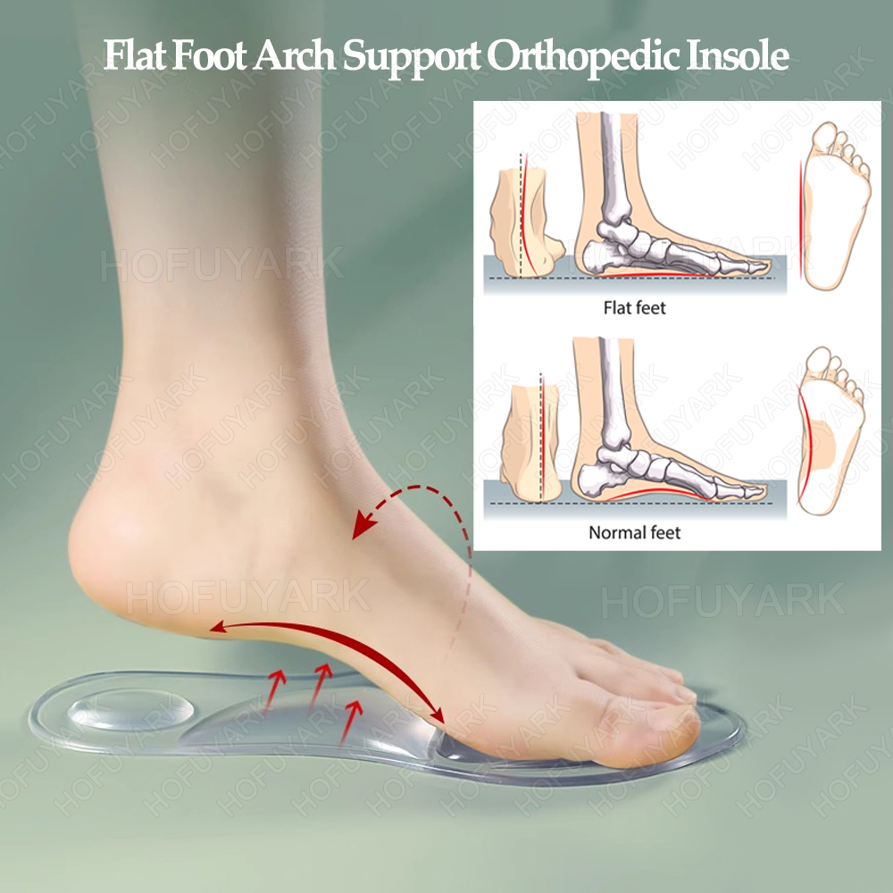 Silicone Gel Insoles Orthopedi - Women'S Shoes Plantar Fasciitis recensie en prijs